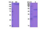 Yfc51.1Mab Humanized Antibody in SDS-PAGE (SDS-PAGE)