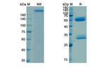 Ganitumab Antibody in SDS-PAGE (SDS-PAGE)