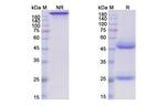 Lerdelimumab Antibody in SDS-PAGE (SDS-PAGE)