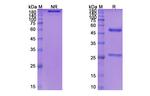 Siltuximab Chimeric Antibody in SDS-PAGE (SDS-PAGE)