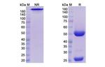 Daratumumab Antibody in SDS-PAGE (SDS-PAGE)