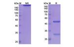 Atinumab Antibody in SDS-PAGE (SDS-PAGE)