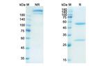 Namilumab Antibody in SDS-PAGE (SDS-PAGE)