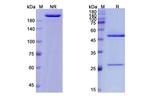 Ixekizumab Humanized Antibody in SDS-PAGE (SDS-PAGE)