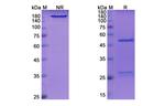 Indatuximab Chimeric Antibody in SDS-PAGE (SDS-PAGE)