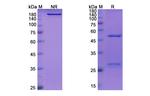 Inclacumab Antibody in SDS-PAGE (SDS-PAGE)