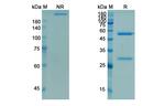 Demcizumab Humanized Antibody in SDS-PAGE (SDS-PAGE)