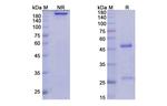 Lirilumab Antibody in SDS-PAGE (SDS-PAGE)