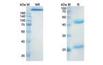 Indusatumab Antibody in SDS-PAGE (SDS-PAGE)