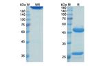 Landogrozumab Humanized Antibody in SDS-PAGE (SDS-PAGE)