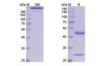 Satralizumab Humanized Antibody in SDS-PAGE (SDS-PAGE)