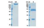 Xentuzumab Antibody in SDS-PAGE (SDS-PAGE)