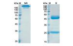 Elezanumab Antibody in SDS-PAGE (SDS-PAGE)