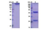 Ianalumab Antibody in SDS-PAGE (SDS-PAGE)