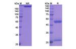 Bersanlimab Antibody in SDS-PAGE (SDS-PAGE)