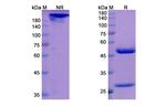 Orilanolimab Chimeric Antibody in SDS-PAGE (SDS-PAGE)