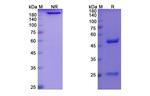 Benufutamab Chimeric Antibody in SDS-PAGE (SDS-PAGE)