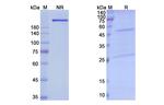 Pacmilimab Antibody in SDS-PAGE (SDS-PAGE)