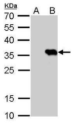 HSV Tag Antibody in Western Blot (WB)