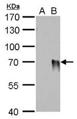 Influenza A H1N1 HA Antibody in Western Blot (WB)