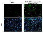 SARS/SARS-CoV-2 Nucleocapsid Antibody in Immunocytochemistry (ICC/IF)