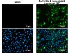 SARS/SARS-CoV-2 Nucleocapsid Antibody in Immunocytochemistry (ICC/IF)