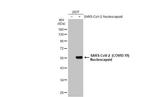 SARS/SARS-CoV-2 Nucleocapsid Antibody in Western Blot (WB)