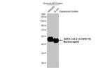 SARS/SARS-CoV-2 Nucleocapsid Antibody in Western Blot (WB)