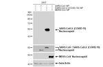 SARS/SARS-CoV-2 Nucleocapsid Antibody in Western Blot (WB)