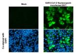 SARS/SARS-CoV-2 Nucleocapsid Antibody in Immunocytochemistry (ICC/IF)