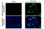 SARS/SARS-CoV-2 Nucleocapsid Antibody in Immunohistochemistry (Paraffin) (IHC (P))