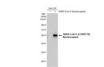 SARS/SARS-CoV-2 Nucleocapsid Antibody in Western Blot (WB)