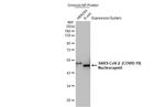 SARS/SARS-CoV-2 Nucleocapsid Antibody in Western Blot (WB)