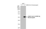 SARS/SARS-CoV-2 Nucleocapsid Antibody in Western Blot (WB)