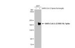 SARS/SARS-CoV-2 Spike Protein S2 Antibody in Western Blot (WB)