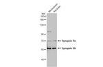 Synapsin II Antibody in Western Blot (WB)