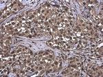 Ubiquitin Antibody in Immunohistochemistry (Paraffin) (IHC (P))