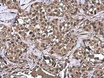 Ubiquitin Antibody in Immunohistochemistry (Paraffin) (IHC (P))