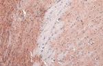 Acetylcholinesterase Antibody in Immunohistochemistry (Paraffin) (IHC (P))