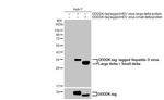 Hepatitis D virus Antibody in Western Blot (WB)