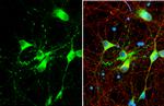 MBP Antibody in Immunocytochemistry (ICC/IF)