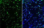 OLIG2 Antibody in Immunohistochemistry (Frozen) (IHC (F))