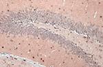 OLIG2 Antibody in Immunohistochemistry (Paraffin) (IHC (P))