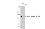 Phospho-ROCK2 (Ser1366) Antibody in Western Blot (WB)