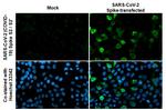 SARS-CoV-2 Spike Protein S2 Antibody in Immunocytochemistry (ICC/IF)