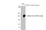 SARS-CoV-2 Spike Protein S2 Antibody in Western Blot (WB)