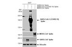 SARS-CoV-2 Spike Protein S2 Antibody in Western Blot (WB)