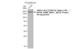 SARS-CoV-2 Spike Protein S2 Antibody in Western Blot (WB)