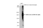 SARS/SARS-CoV-2 Spike Protein S2 Antibody in Western Blot (WB)