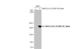 SARS/SARS-CoV-2 Spike Protein S2 Antibody in Western Blot (WB)